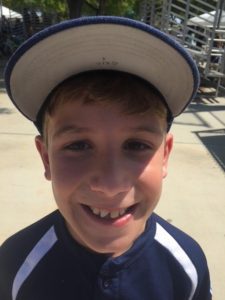 Baseball Safety: Picture of a baseball player with a chipped tooth after a collision at first base