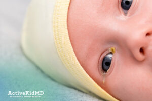active kid md common causes blocked tear ducts